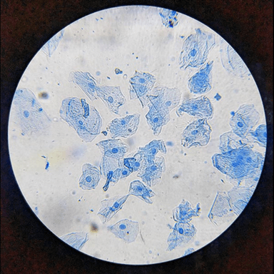 Cheek Cell Smear