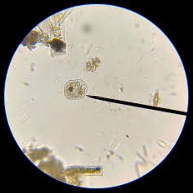 Pond Water Exploration